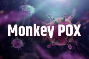 Monkeypox information